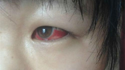 欧美激情视频在线观看 光触媒除甲醛保护新装修教室空气，更保护孩子们